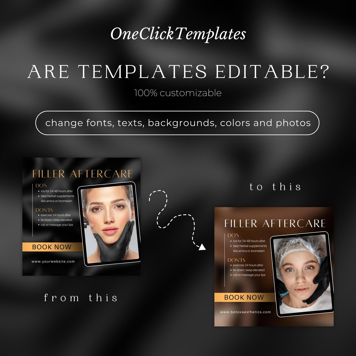 70 modèles Instagram de Botox et de remplissage dorés