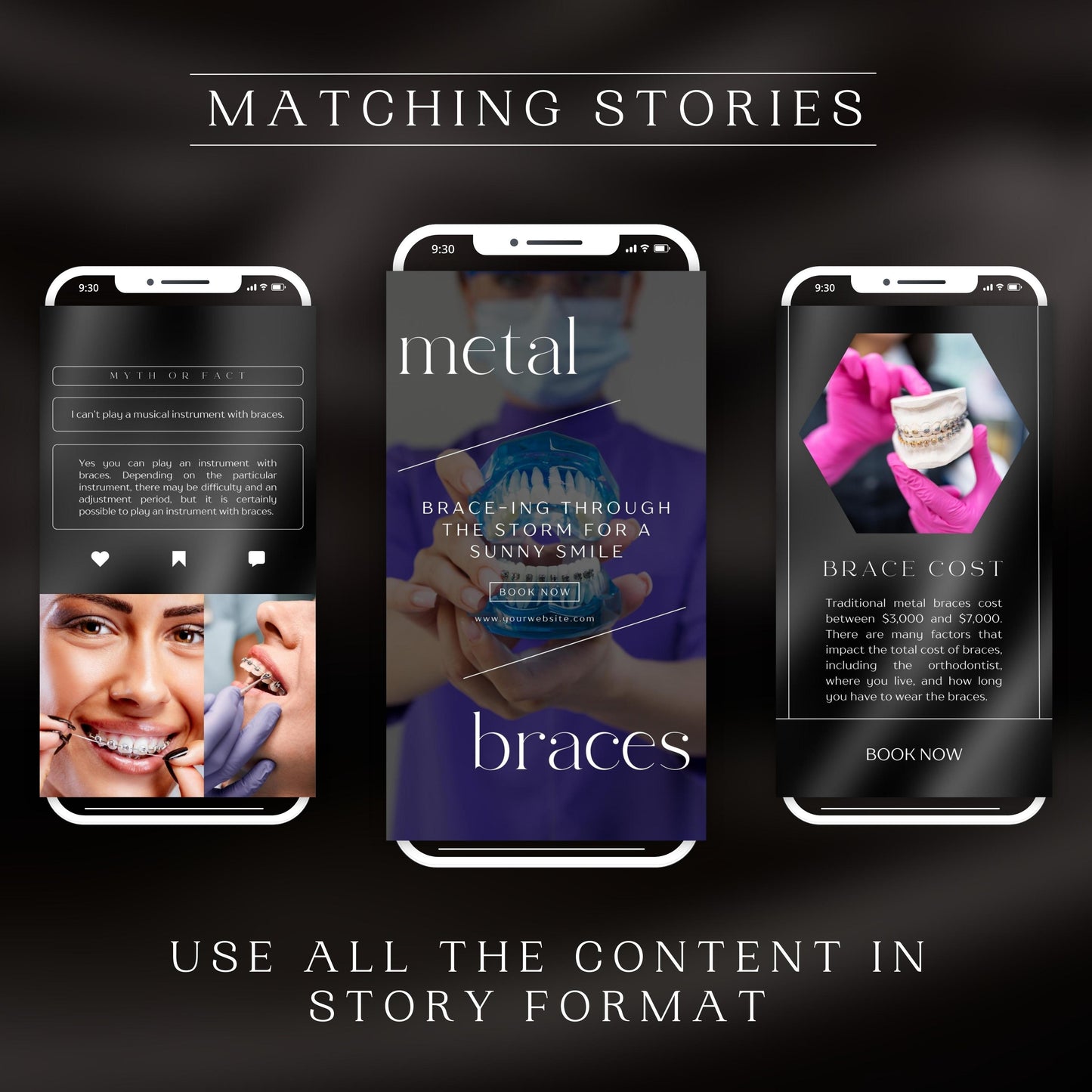 Dental Braces Instagram Templates