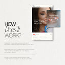 Dental Veneers Social Media Pack