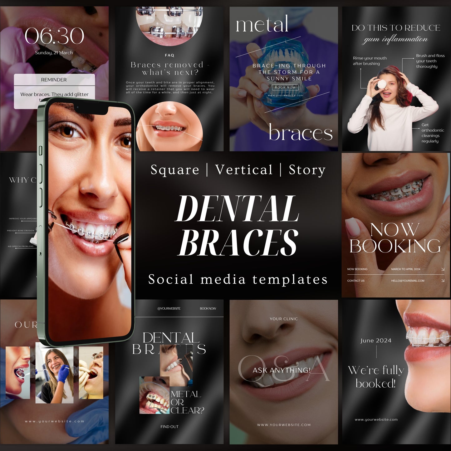 80 Dental Braces Instagram Templates