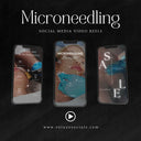 Microneedling Instagram Reels Videos