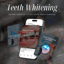 120 modèles Instagram de blanchiment des dents