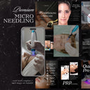 Microneedling social media templates