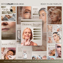 Botox&Fillers Instagram Templates