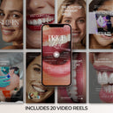 Teeth Whitening Social Media Video Reels