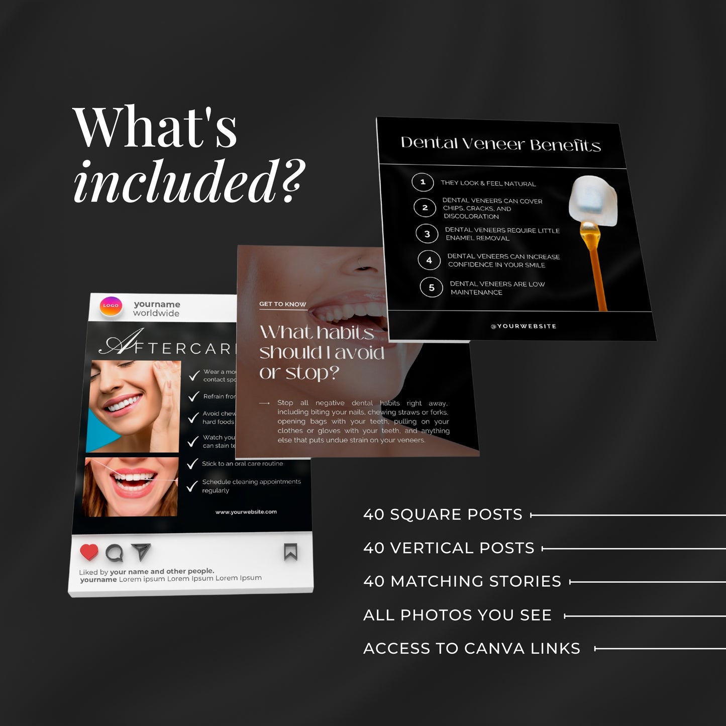 80 Dental Veneers Instagram Templates