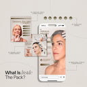 Botox&Fillers Instagram Templates