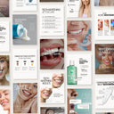 120 modèles Instagram de blanchiment des dents