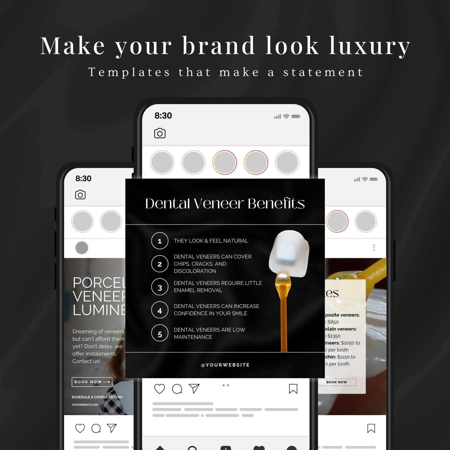 80 Dental Veneers Instagram Templates