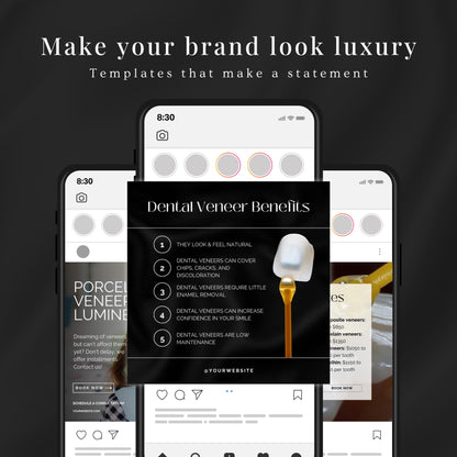 80 Dental Veneers Instagram Templates