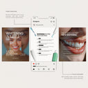 120 modèles Instagram de blanchiment des dents