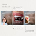Dental Veneers Social Media Pack