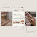 Chemical Peel Social Media Pack