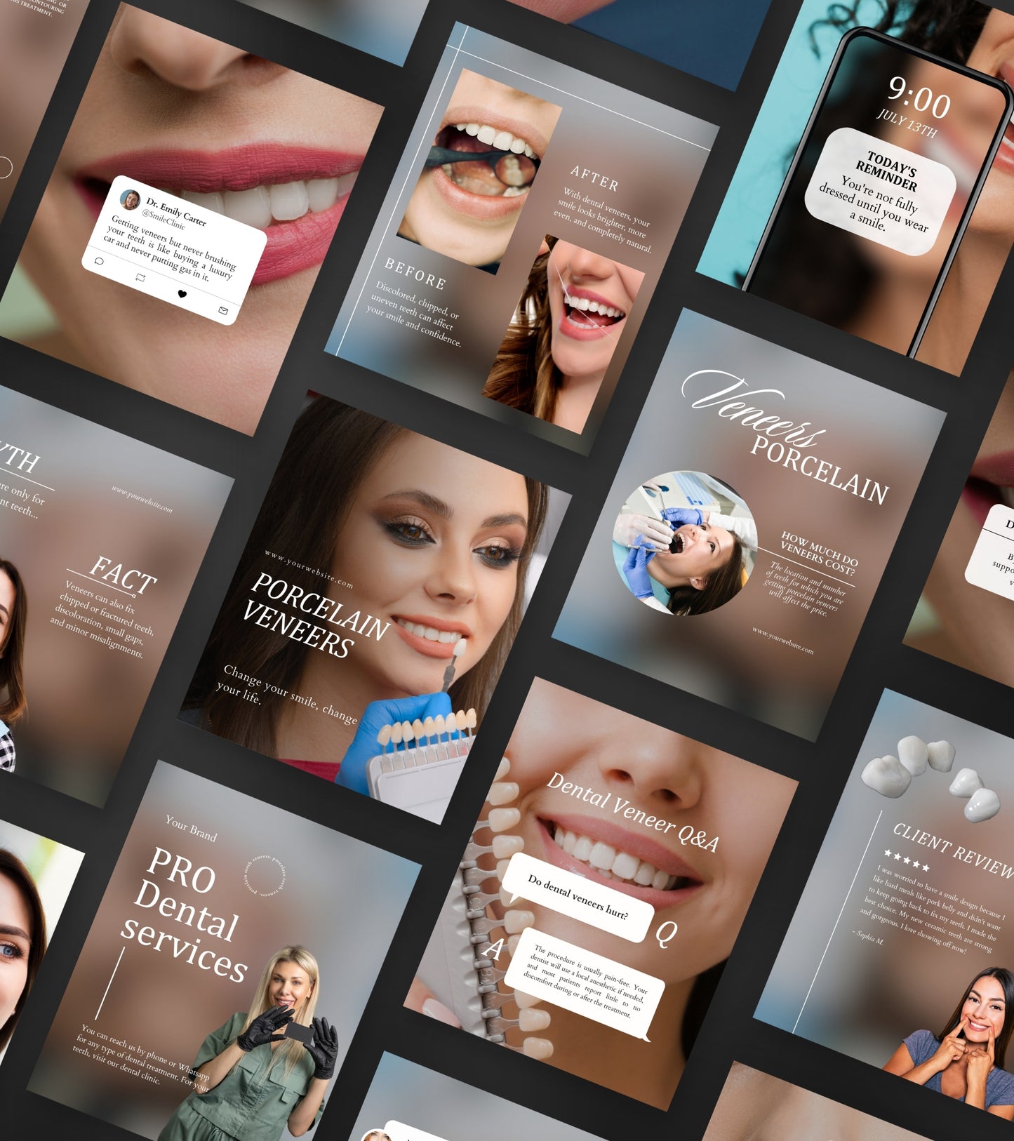 Dental Veneers Social Media Pack