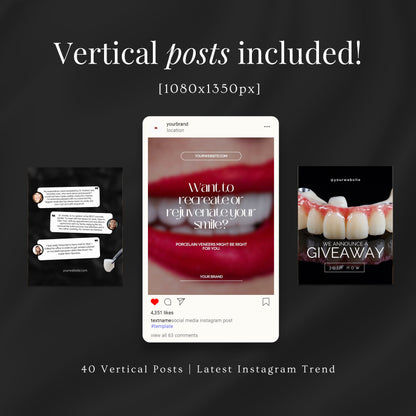 80 Dental Veneers Instagram Templates