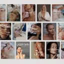 Laser Skin Resurfacing social media template
