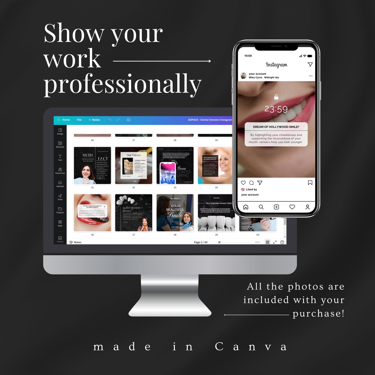 80 Dental Veneers Instagram Templates
