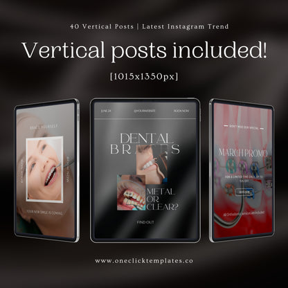 80 Dental Braces Instagram Templates