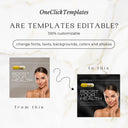 IV Therapy Beige Instagram Templates