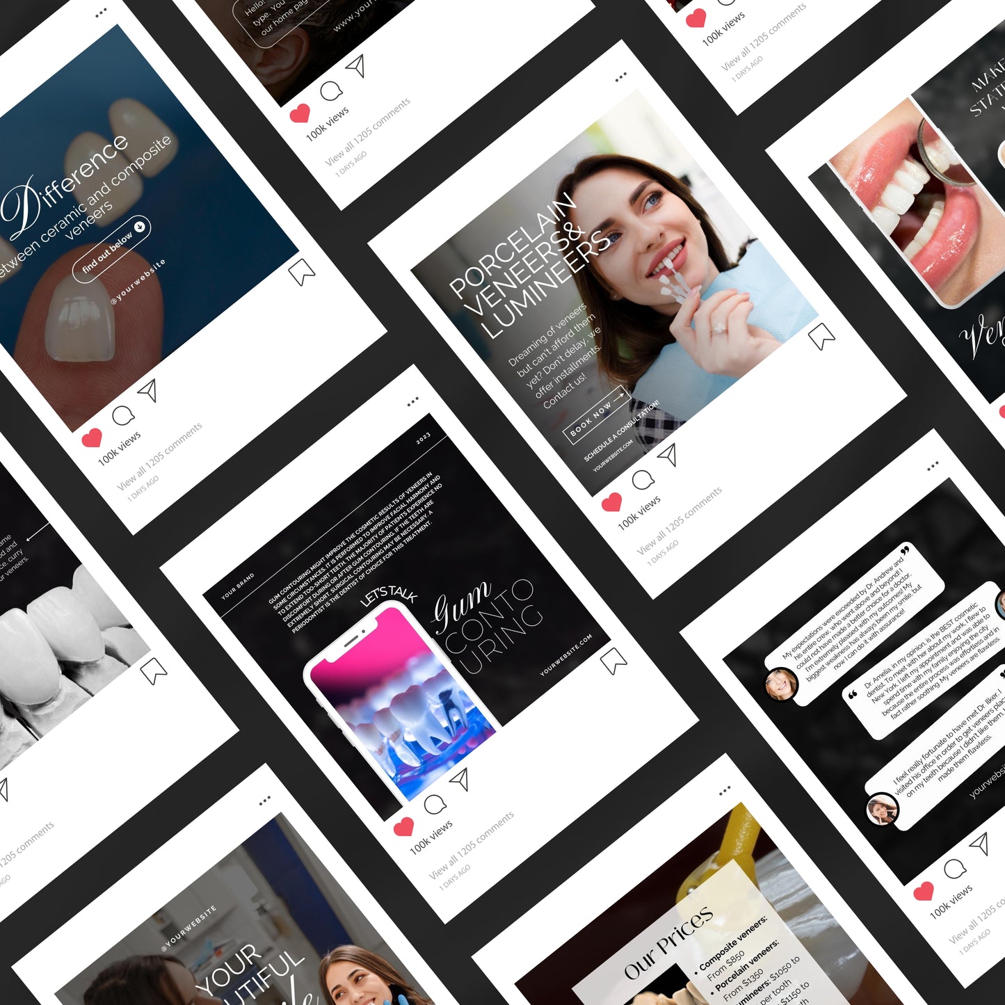 80 Dental Veneers Instagram Templates