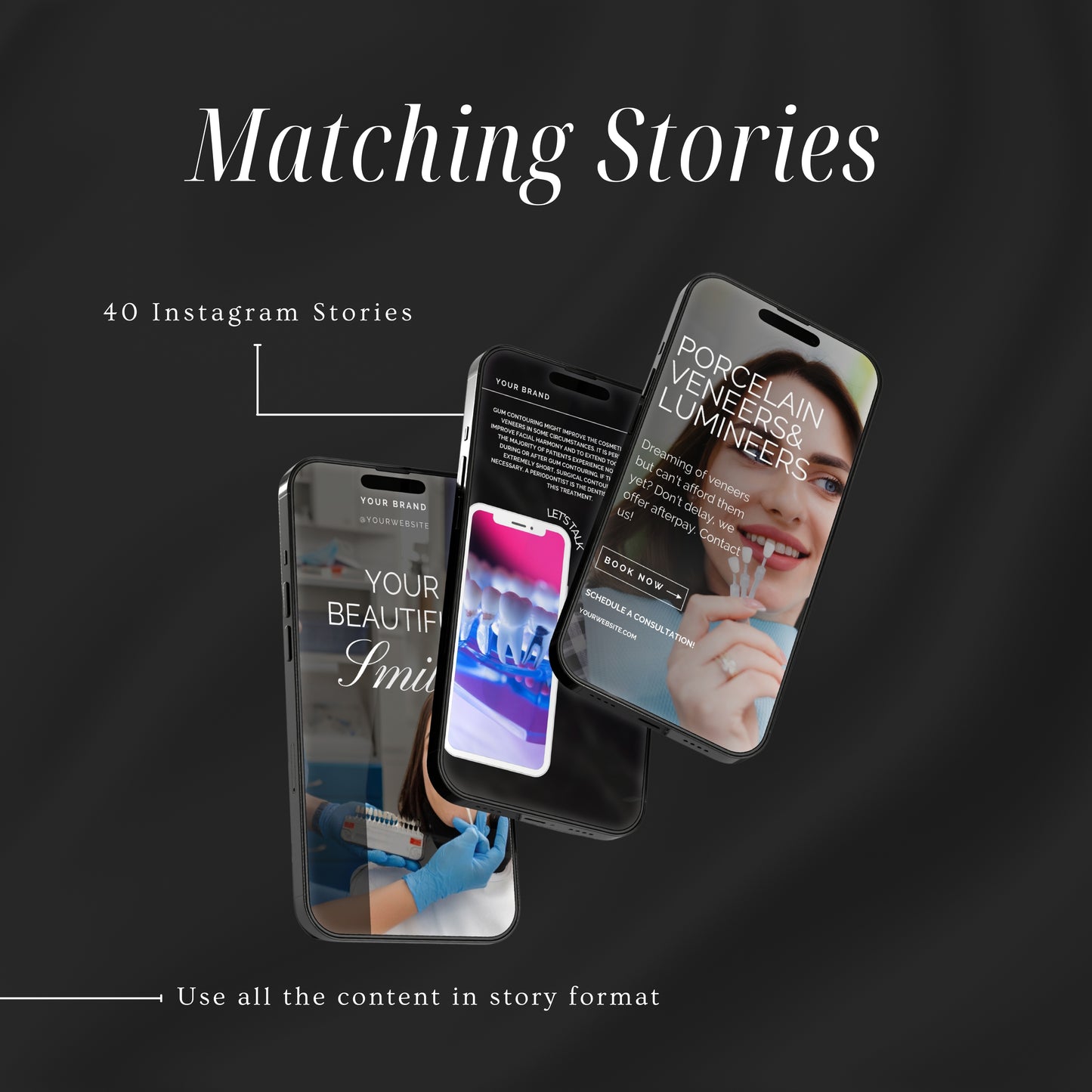 80 Dental Veneers Instagram Templates