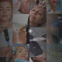 15 Microneedling-Instagram-Reel-Videos